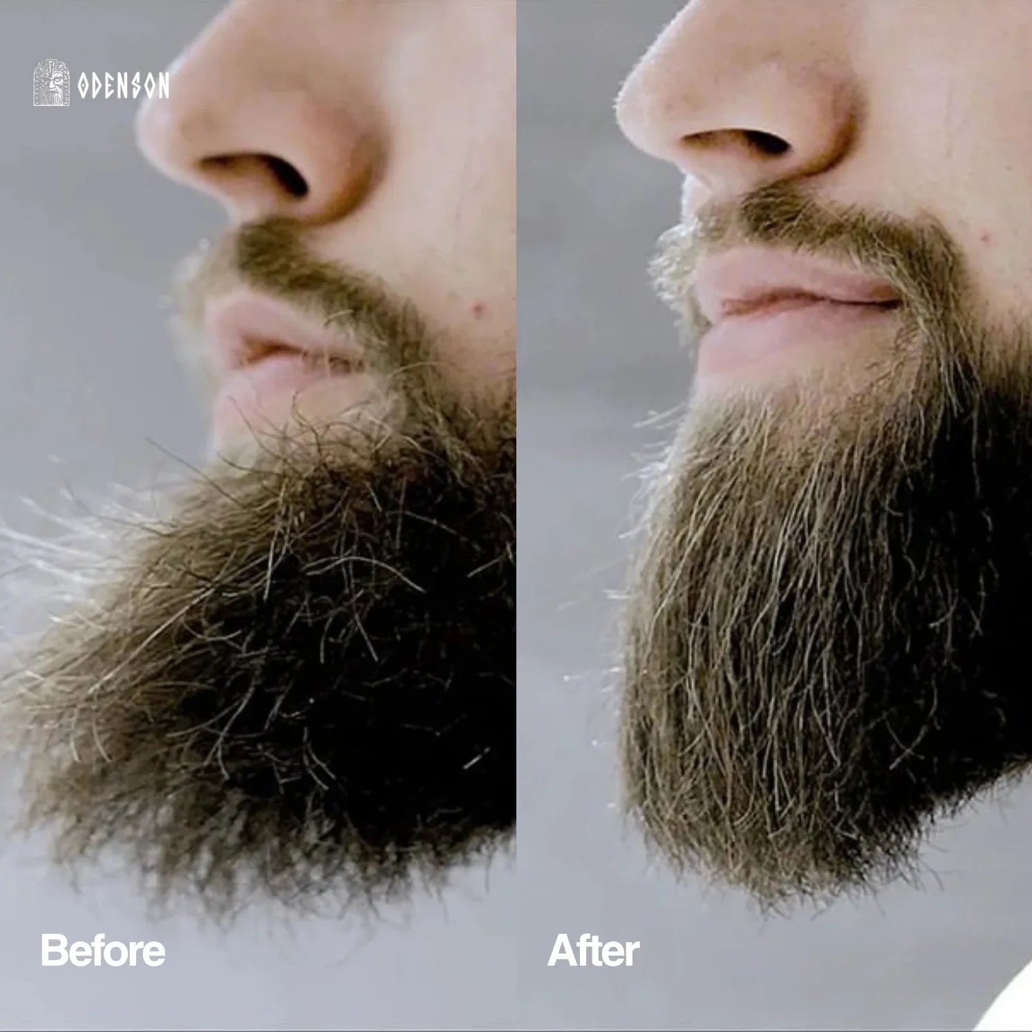 Beard Forger